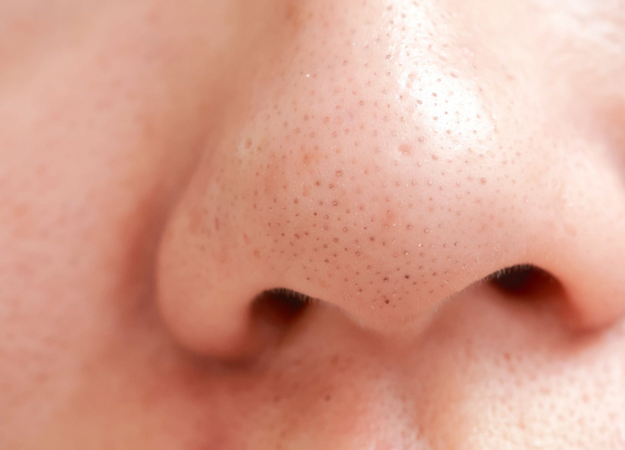 A Holistic Aesthetician’s Tips for Tackling Stubborn Blackheads - ORESTA clean beauty simplified