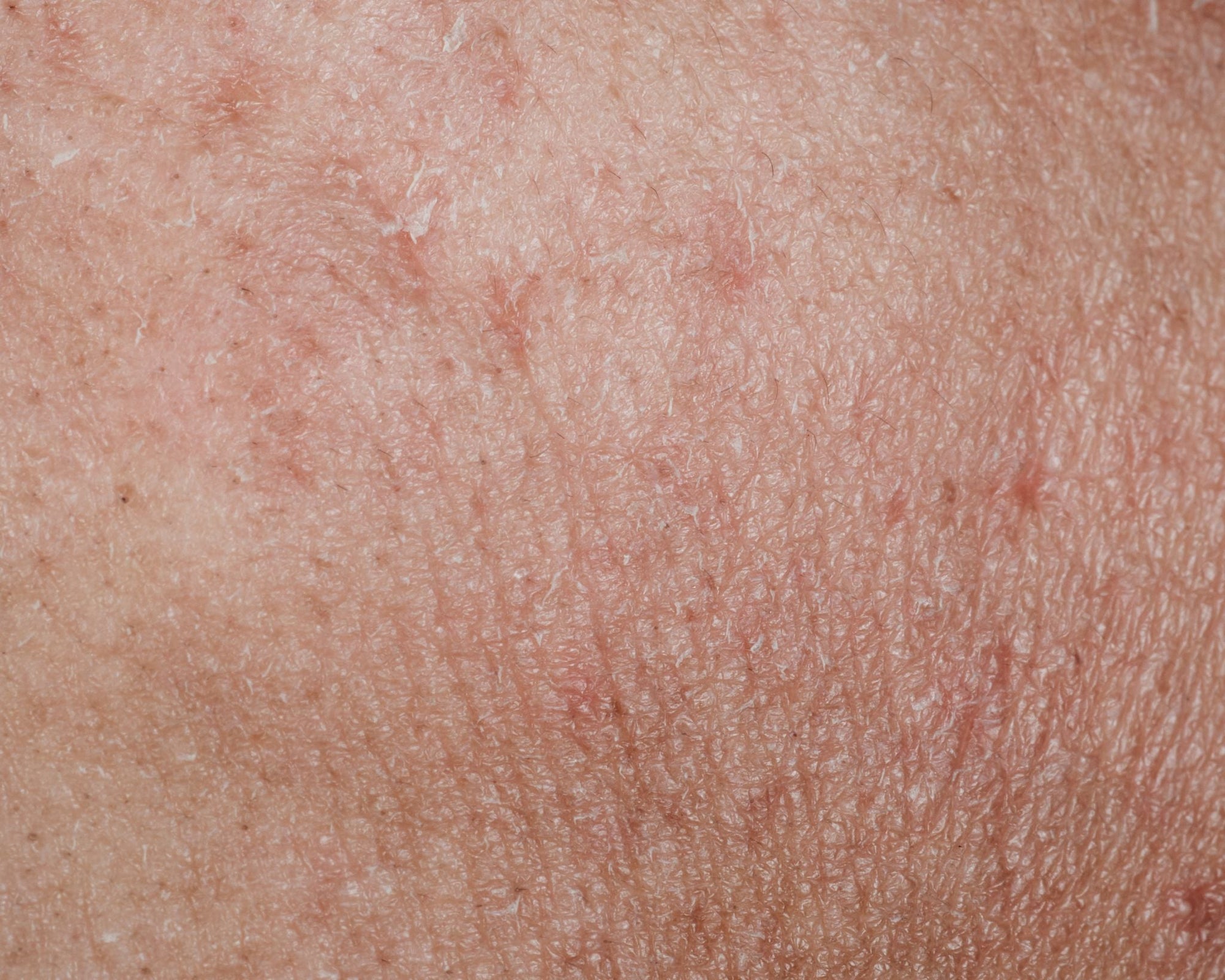 Is Your Skin Barrier Healthy? Understanding + Strengthening Your Skin's Defense - ORESTA clean beauty simplified