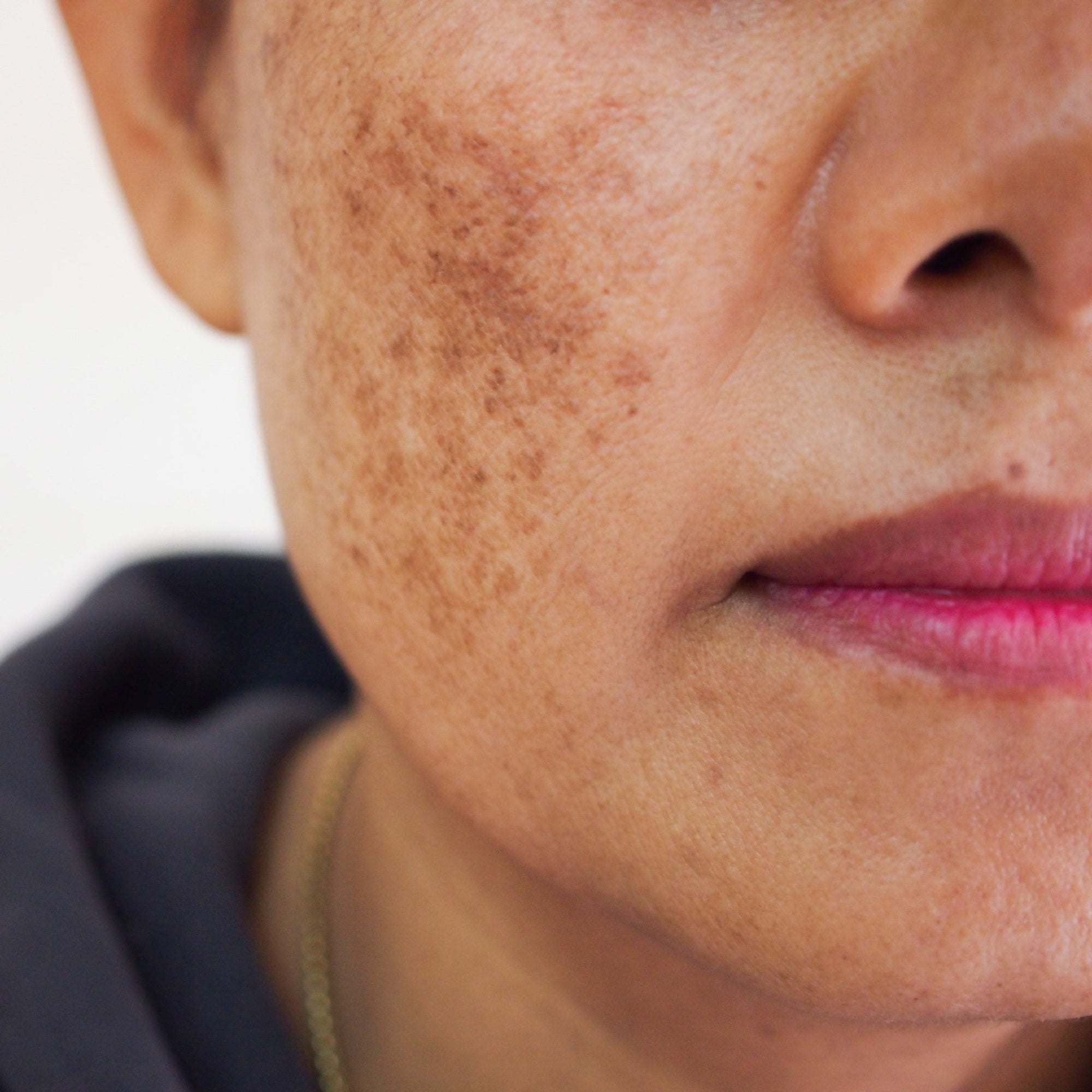 Sun-Damaged + Pigmented Skin - ORESTA clean beauty simplified