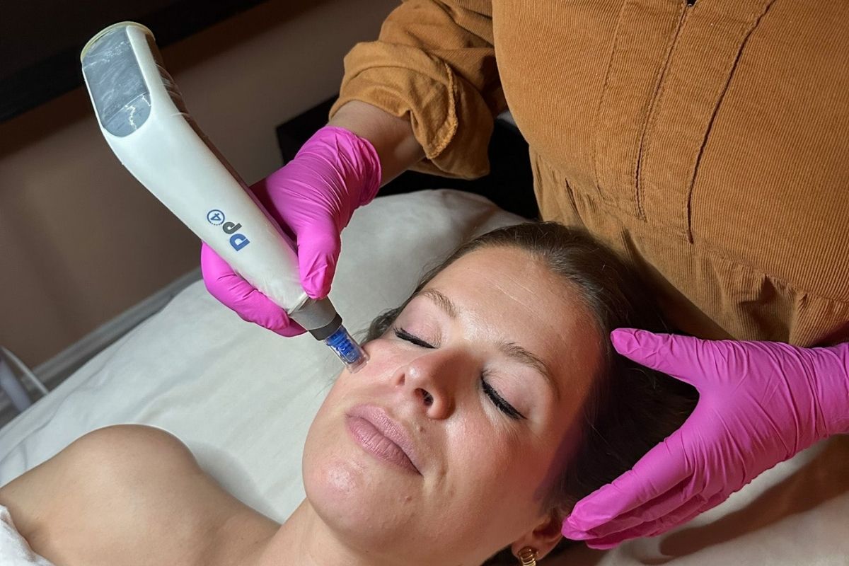 What Does Microneedling Actually Do? - ORESTA mindful beauty