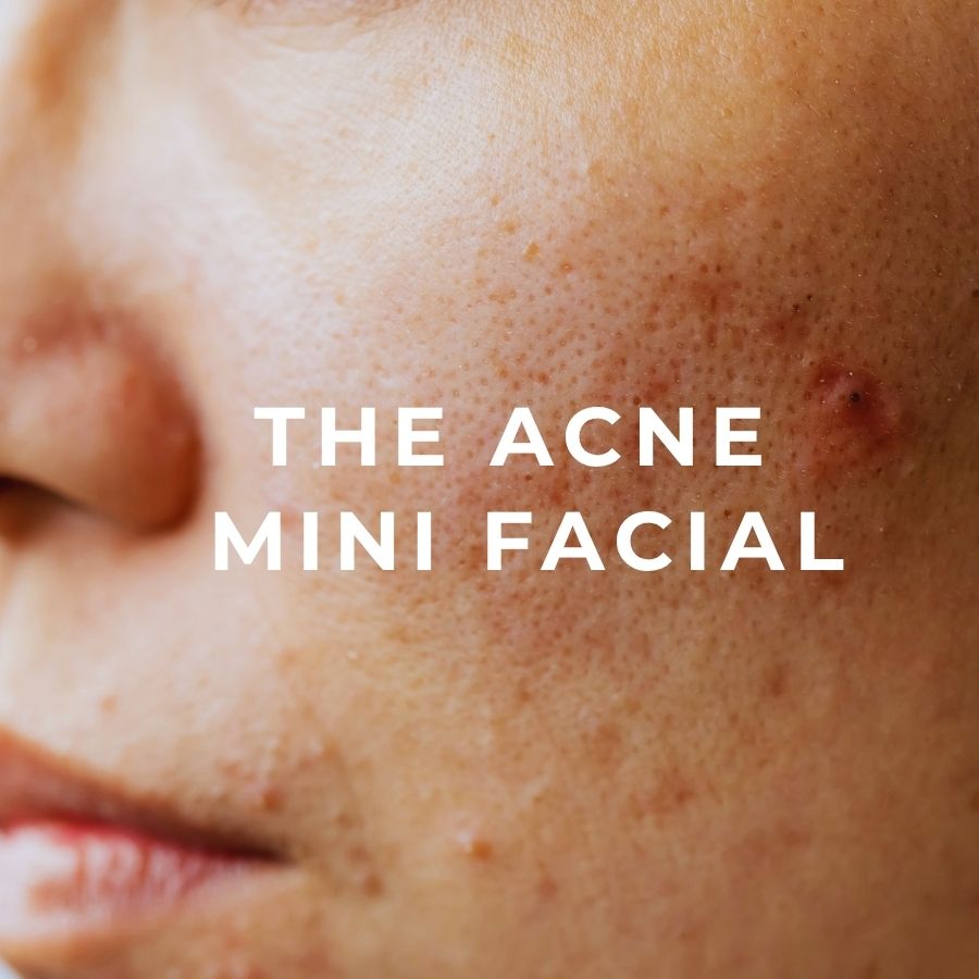 ORESTA - Acne Mini Facial - ORESTA mindful beauty